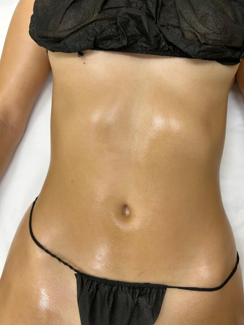 Masaje Drenaje Linfático Brasileño